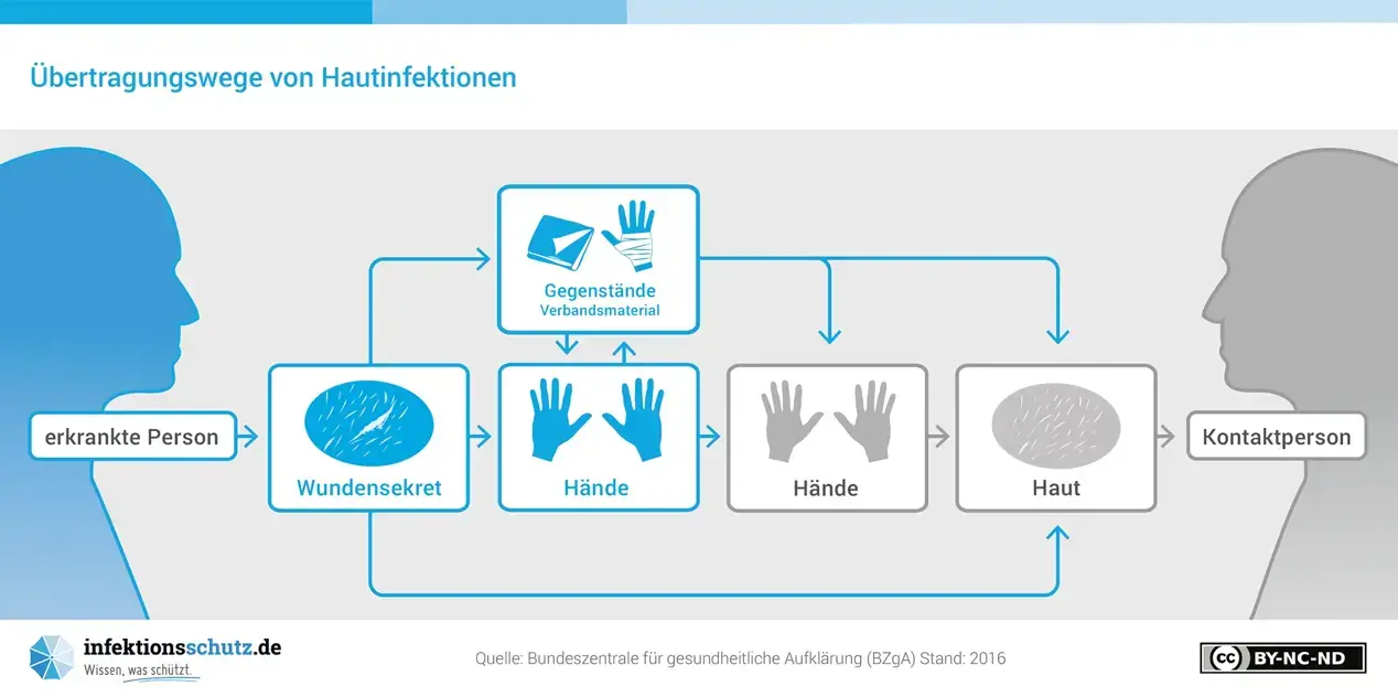 Vorschaubild des Plakats "Wie werden Hautinfektionen übertragen?"