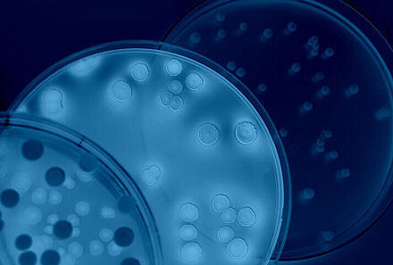 Petrischale (© iStock / Ca-ssis)