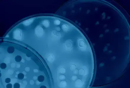 Petrischale (© iStock / Ca-ssis)