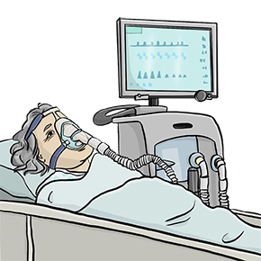 Die Illustration zeigt eine Damen in einem Krankenhausbett, die eine Atemmaske trägt, mit der sie an ein Gerät angeschlossen ist, das hinter ihr steht.